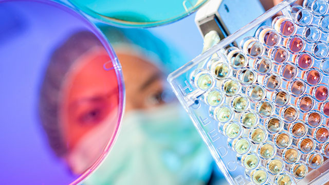 Essential Insights | Common Protein Detection Methods Used in the Lab image