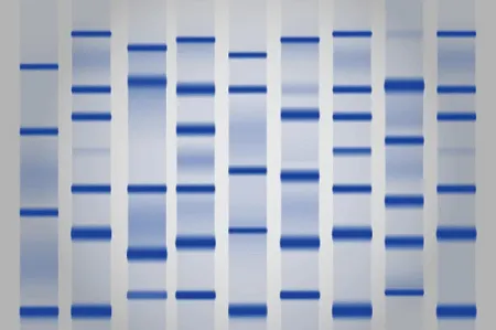 Essential Insights | Common Protein Detection Methods Used in the Lab image